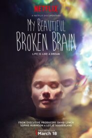My Beautiful Broken Brain – Στα Μονοπάτια του Μυαλού μου